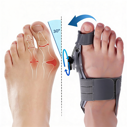 Treatmedy Bunion Fix